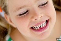 Child’s Loose Tooth: When to Worry and What to Do